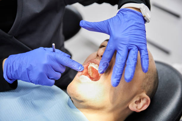 Best Dentist for Tooth Abscess  in Polo, IL